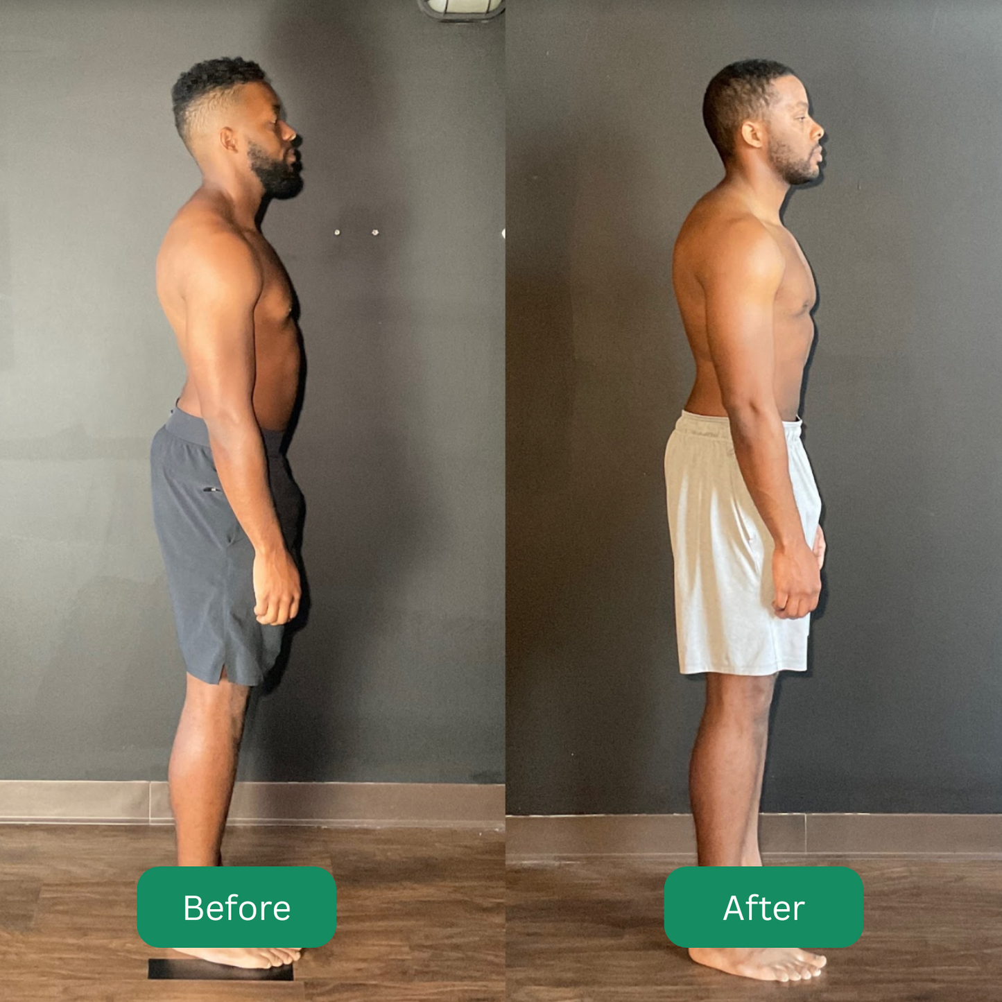 Instant Posture Corrector